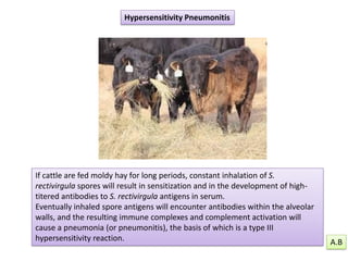 Hypersensitivity Pneumonitis
If cattle are fed moldy hay for long periods, constant inhalation of S.
rectivirgula spores will result in sensitization and in the development of high-
titered antibodies to S. rectivirgula antigens in serum.
Eventually inhaled spore antigens will encounter antibodies within the alveolar
walls, and the resulting immune complexes and complement activation will
cause a pneumonia (or pneumonitis), the basis of which is a type III
hypersensitivity reaction. A.B
 