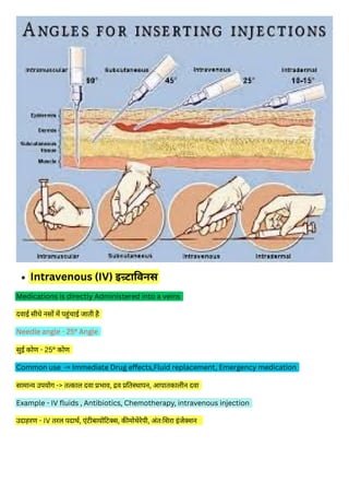 type of injection इंजेक्शन का प्रकार_20250223_134440_0000.pdf