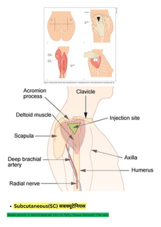 type of injection इंजेक्शन का प्रकार_20250223_134440_0000.pdf