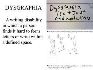 A writing disability
in which a person
finds it hard to form
letters or write within
a defined space.
 