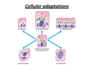 Cellular adaptations
 