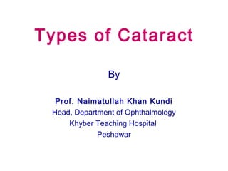Types of Cataract
By
Prof. Naimatullah Khan Kundi
Head, Department of Ophthalmology
Khyber Teaching Hospital
Peshawar
 