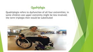 Quadriplegia
Quadriplegia refers to dysfunction of all four extremities; in
some children one upper extremity might be less involved;
the term triplegia then would be substituted
 