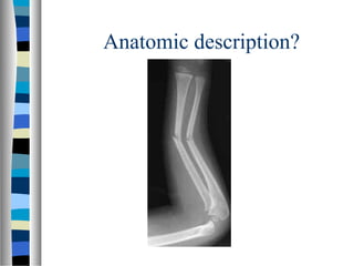 Anatomic description?
 