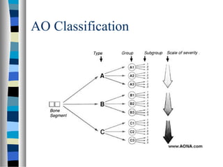 AO Classification
 