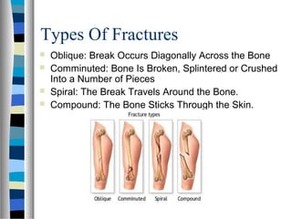 Types Of Fractures
 Oblique: Break Occurs Diagonally Across the Bone
 Comminuted: Bone Is Broken, Splintered or Crushed
Into a Number of Pieces
 Spiral: The Break Travels Around the Bone.
 Compound: The Bone Sticks Through the Skin.
 
