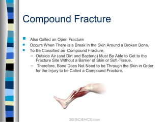 Compound Fracture
 Also Called an Open Fracture
 Occurs When There is a Break in the Skin Around a Broken Bone.
 To Be Classified as Compound Fracture,
– Outside Air (and Dirt and Bacteria) Must Be Able to Get to the
Fracture Site Without a Barrier of Skin or Soft-Tissue.
– Therefore, Bone Does Not Need to be Through the Skin in Order
for the Injury to be Called a Compound Fracture.
 