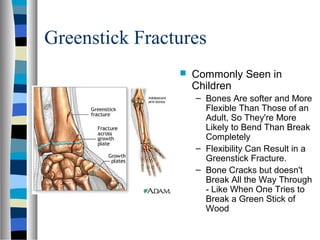Greenstick Fractures
 Commonly Seen in
Children
– Bones Are softer and More
Flexible Than Those of an
Adult, So They're More
Likely to Bend Than Break
Completely
– Flexibility Can Result in a
Greenstick Fracture.
– Bone Cracks but doesn't
Break All the Way Through
- Like When One Tries to
Break a Green Stick of
Wood
 