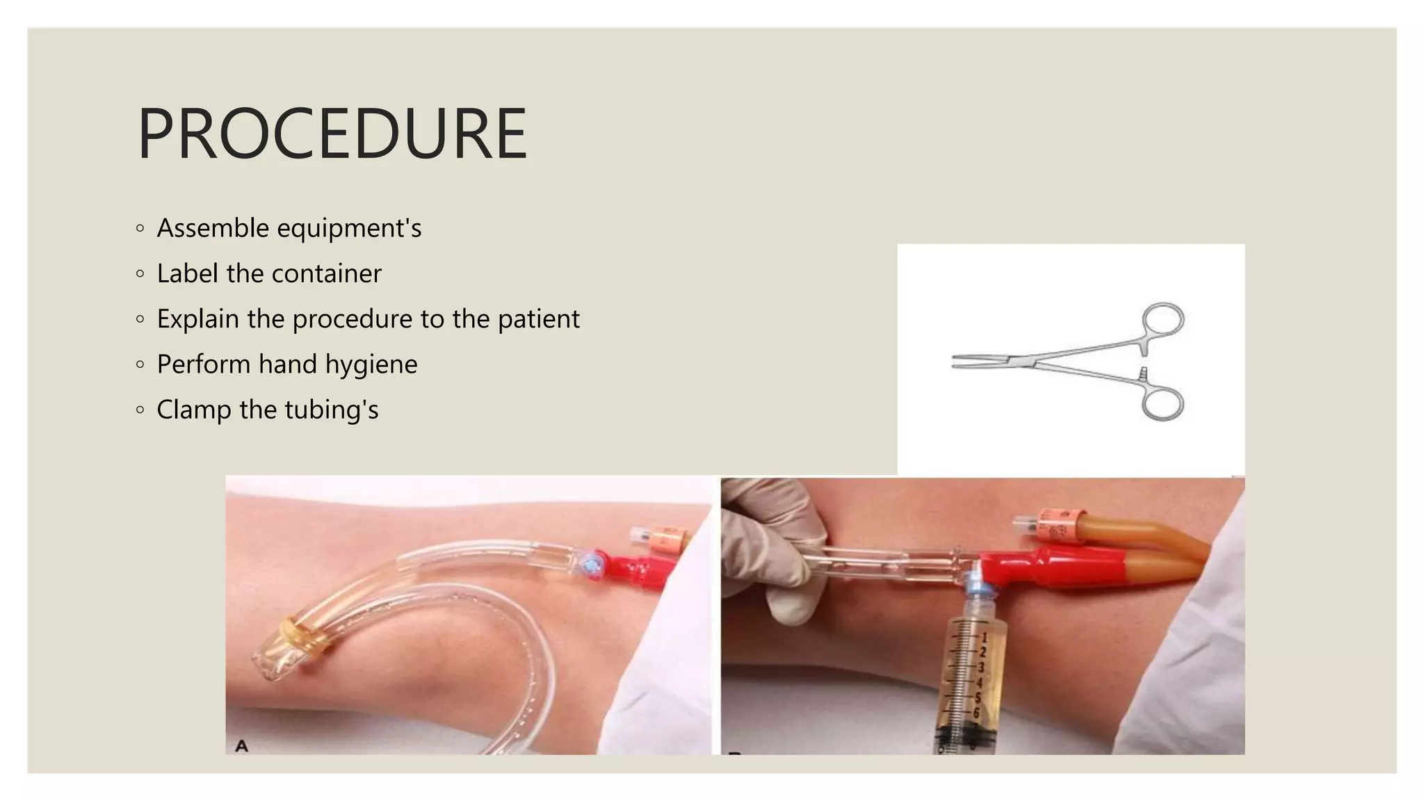 PROCEDURE
◦ Assemble equipment's
◦ Label the container
◦ Explain the procedure to the patient
◦ Perform hand hygiene
◦ Clamp the tubing's
 