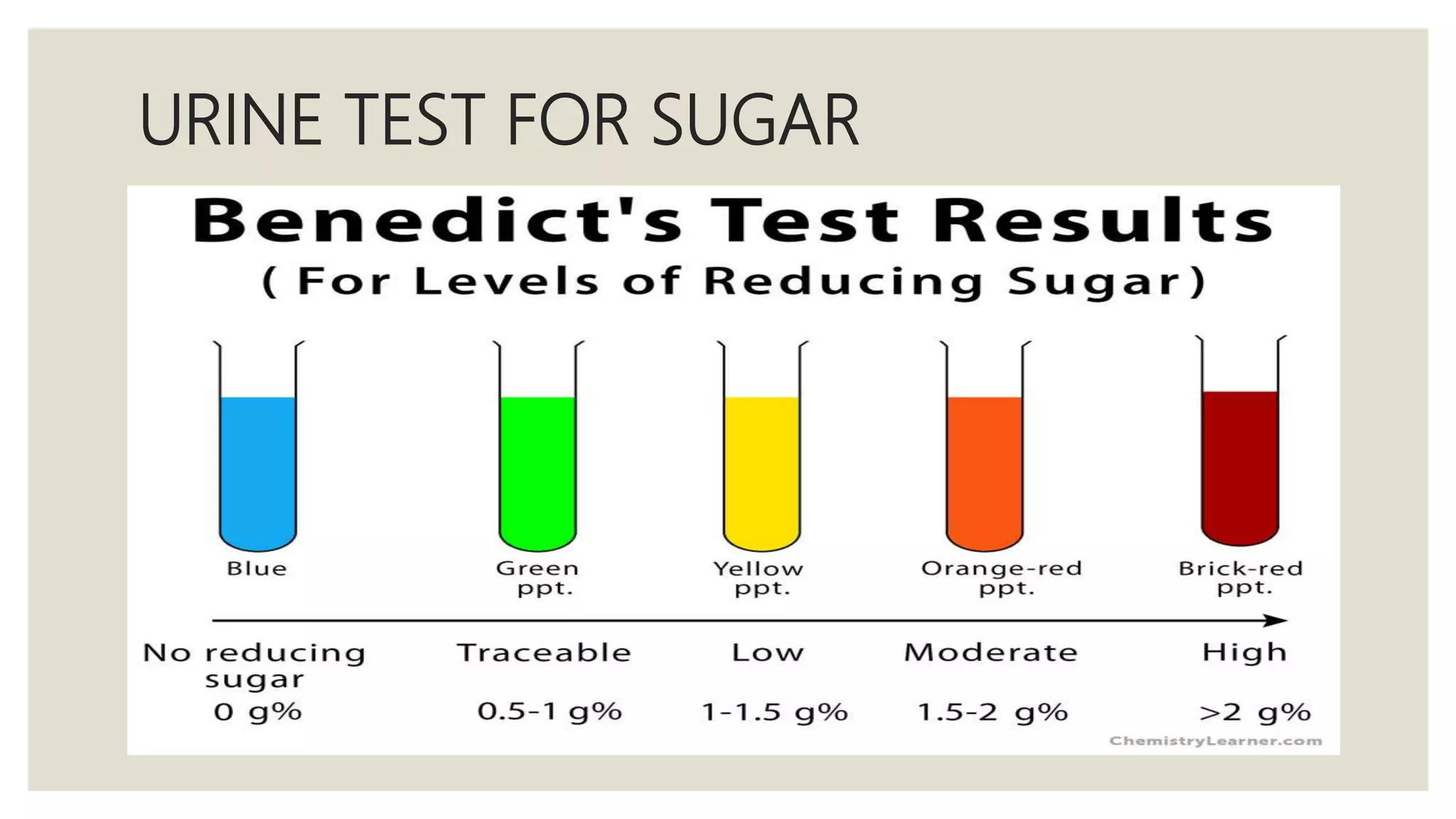 URINE TEST FOR SUGAR
 