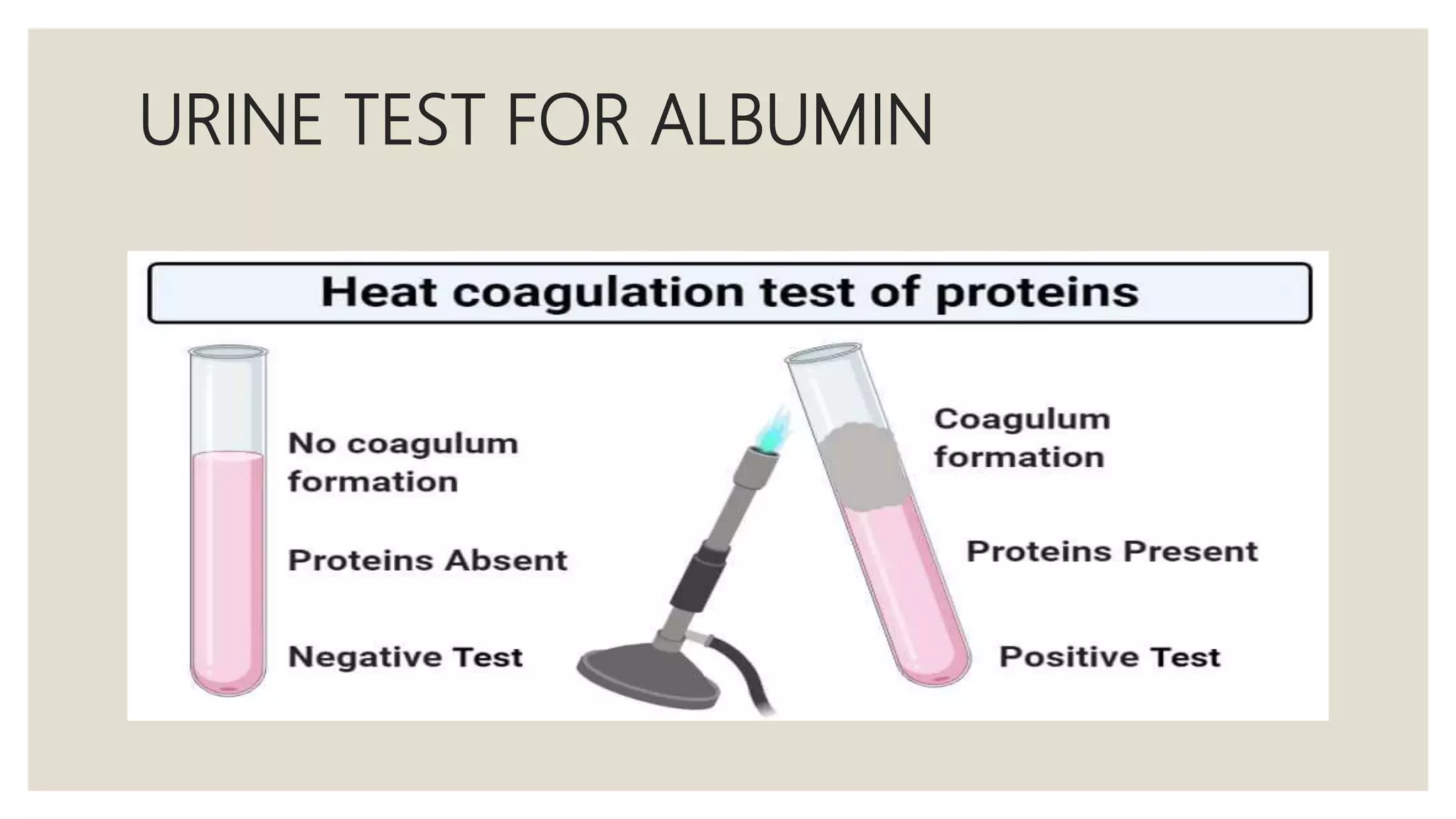 URINE TEST FOR ALBUMIN
 