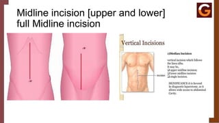 Types of abdominal surgeries and types of abdominal incisions.pptx