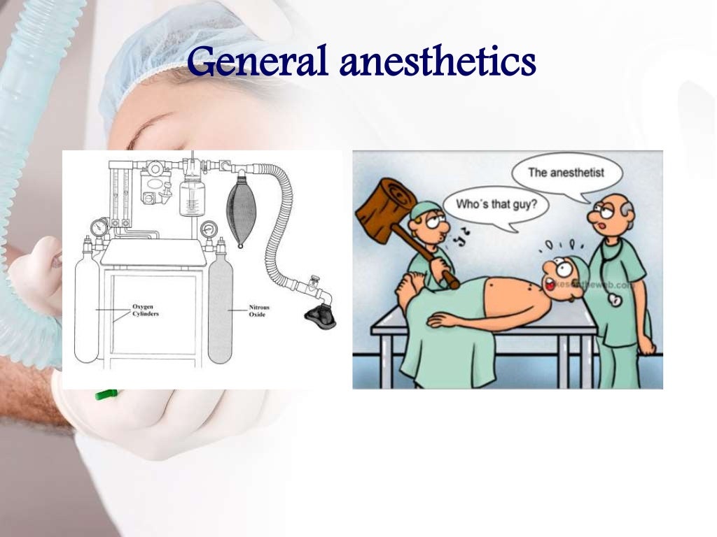 Types of anesthesia