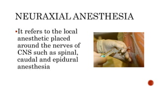It refers to the local
anesthetic placed
around the nerves of
CNS such as spinal,
caudal and epidural
anesthesia
 