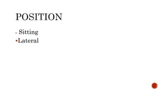  Sitting
Lateral
 