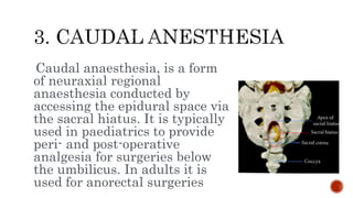 Caudal anaesthesia, is a form
of neuraxial regional
anaesthesia conducted by
accessing the epidural space via
the sacral hiatus. It is typically
used in paediatrics to provide
peri- and post-operative
analgesia for surgeries below
the umbilicus. In adults it is
used for anorectal surgeries
 