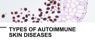 TYPES OF AUTOIMMUNE
SKIN DISEASES
 