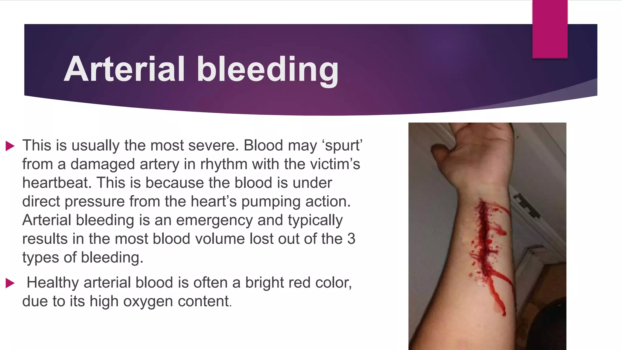 Types of bleeding ppt ppt