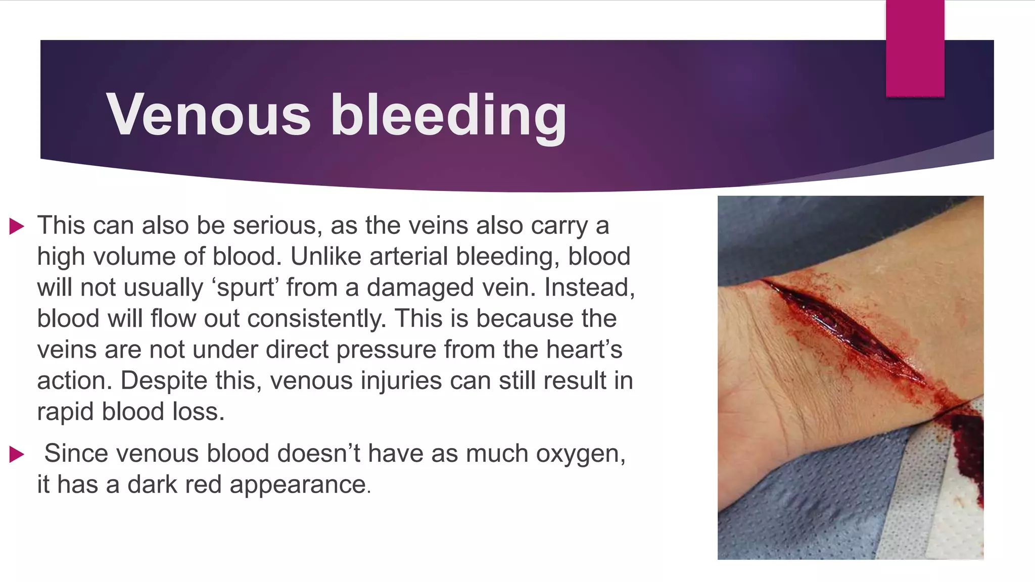 Venous bleeding
 This can also be serious, as the veins also carry a
high volume of blood. Unlike arterial bleeding, blood
will not usually ‘spurt’ from a damaged vein. Instead,
blood will flow out consistently. This is because the
veins are not under direct pressure from the heart’s
action. Despite this, venous injuries can still result in
rapid blood loss.
 Since venous blood doesn’t have as much oxygen,
it has a dark red appearance.
 