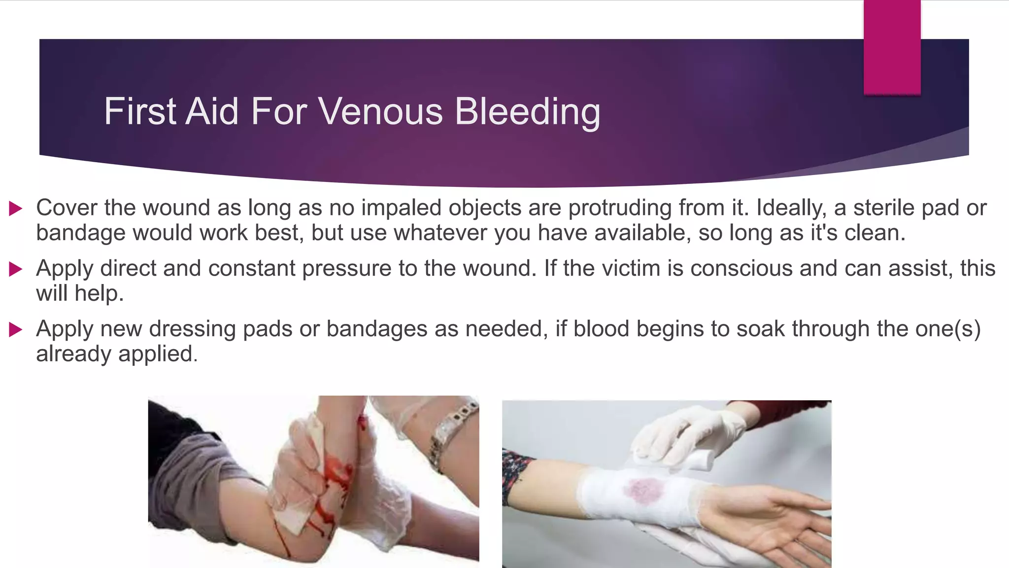 First Aid For Venous Bleeding
 Cover the wound as long as no impaled objects are protruding from it. Ideally, a sterile pad or
bandage would work best, but use whatever you have available, so long as it's clean.
 Apply direct and constant pressure to the wound. If the victim is conscious and can assist, this
will help.
 Apply new dressing pads or bandages as needed, if blood begins to soak through the one(s)
already applied.
 