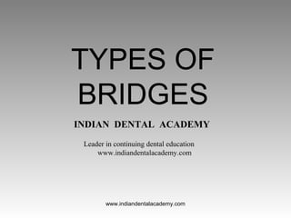 TYPES OF
BRIDGES
INDIAN DENTAL ACADEMY
Leader in continuing dental education
www.indiandentalacademy.com
www.indiandentalacademy.com
 