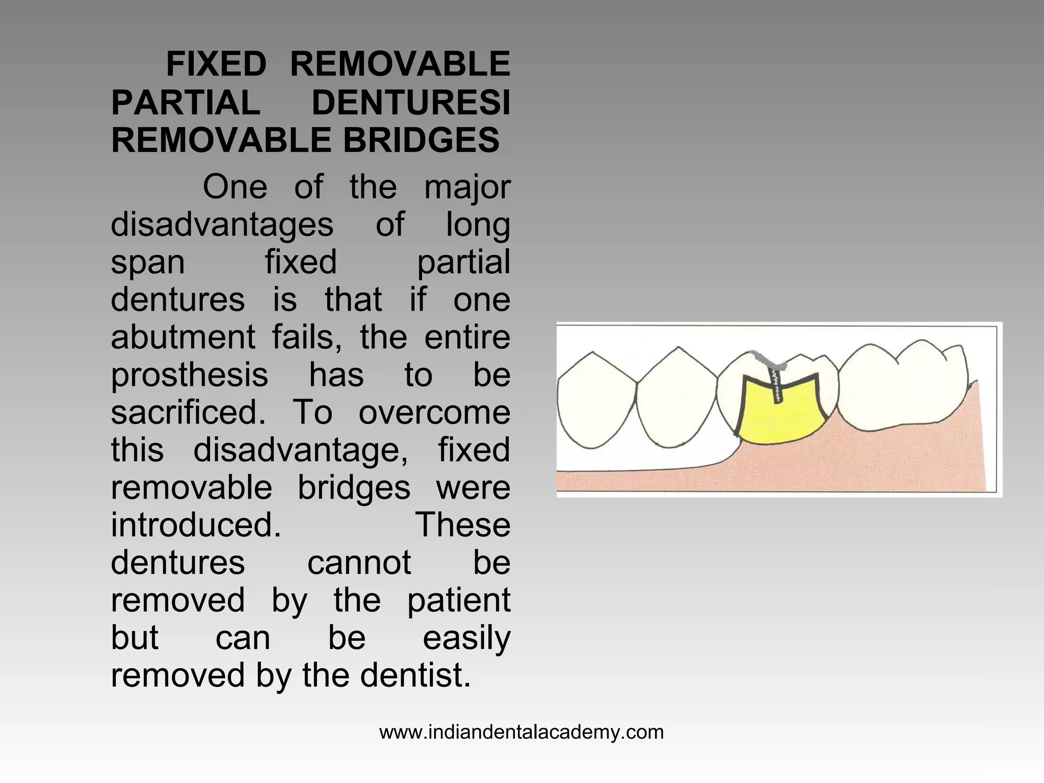 FIXED REMOVABLE
PARTIAL DENTURESI
REMOVABLE BRIDGES
One of the major
disadvantages of long
span fixed partial
dentures is that if one
abutment fails, the entire
prosthesis has to be
sacrificed. To overcome
this disadvantage, fixed
removable bridges were
introduced. These
dentures cannot be
removed by the patient
but can be easily
removed by the dentist.
www.indiandentalacademy.com
 