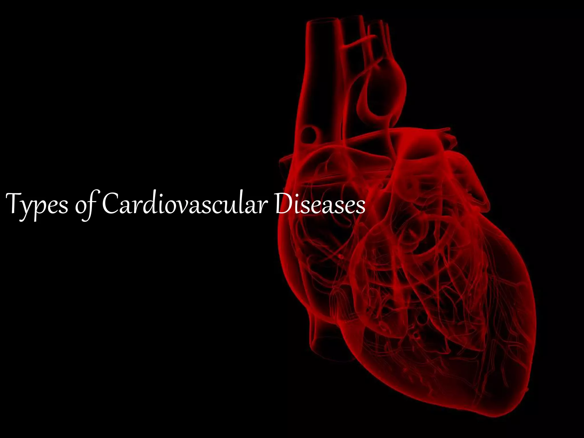 Types of cardiovascular diseases | PPTX
