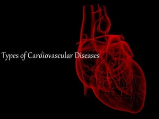 Types of Cardiovascular Diseases
 