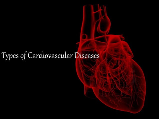 Types of cardiovascular diseases | PPTX