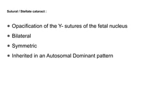 Sutural / Stellate cataract :
● Opacification of the Y- sutures of the fetal nucleus
● Bilateral
● Symmetric
● Inherited in an Autosomal Dominant pattern
 