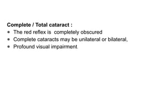 Complete / Total cataract :
● The red reflex is completely obscured
● Complete cataracts may be unilateral or bilateral,
● Profound visual impairment.
 