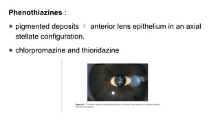 Phenothiazines :
● pigmented deposits  anterior lens epithelium in an axial
stellate configuration.
● chlorpromazine and thioridazine
 