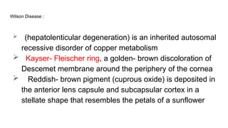 Wilson Disease :
 (hepatolenticular degeneration) is an inherited autosomal
recessive disorder of copper metabolism
 Kayser- Fleischer ring, a golden- brown discoloration of
Descemet membrane around the periphery of the cornea
 Reddish- brown pigment (cuprous oxide) is deposited in
the anterior lens capsule and subcapsular cortex in a
stellate shape that resembles the petals of a sunflower
 