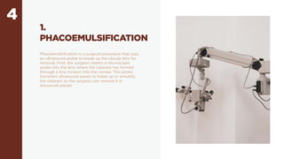 4
1.
PHACOEMULSIFICATION
Phacoemulsification is a surgical procedure that uses
an ultrasound probe to break up the cloudy lens for
removal. First, the surgeon inserts a microscopic
probe into the lens where the cataract has formed
through a tiny incision into the cornea. This probe
transmits ultrasound waves to break up or emulsify
the cataract so the surgeon can remove it in
minuscule pieces.
 