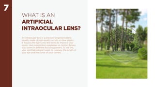 7
WHAT IS AN
ARTIFICIAL
INTRAOCULAR LENS?
An intraocular lens is a precisely engineered lens
usually made of high-quality acrylic or clear plastic.
It focuses the light onto the retina to improve your
vision. Like prescription eyeglasses or contact lenses,
IOLs come in different focusing powers. To set this,
your ophthalmologist needs to measure the length of
your eye and the curve of your cornea.
 