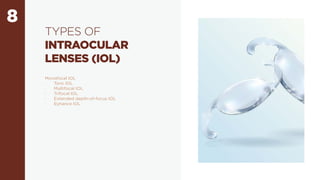 8
TYPES OF
INTRAOCULAR
LENSES (IOL)
Monofocal IOL
· Toric IOL
· Multifocal IOL
· Trifocal IOL
· Extended depth-of-focus IOL
· Eyhance IOL
 