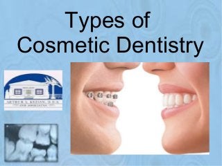 Types of 
Cosmetic Dentistry 
 