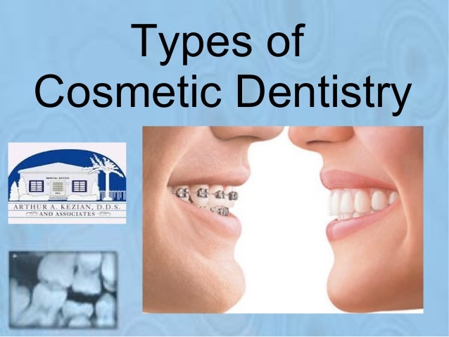 Types of cosmetic dentistry Types of cosmetic dentistry