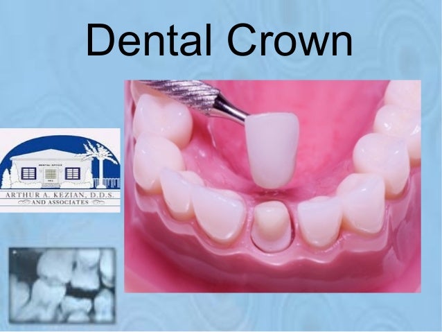 Types of cosmetic dentistry Types of cosmetic dentistry