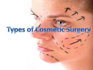 Types of Cosmetic Surgery
 