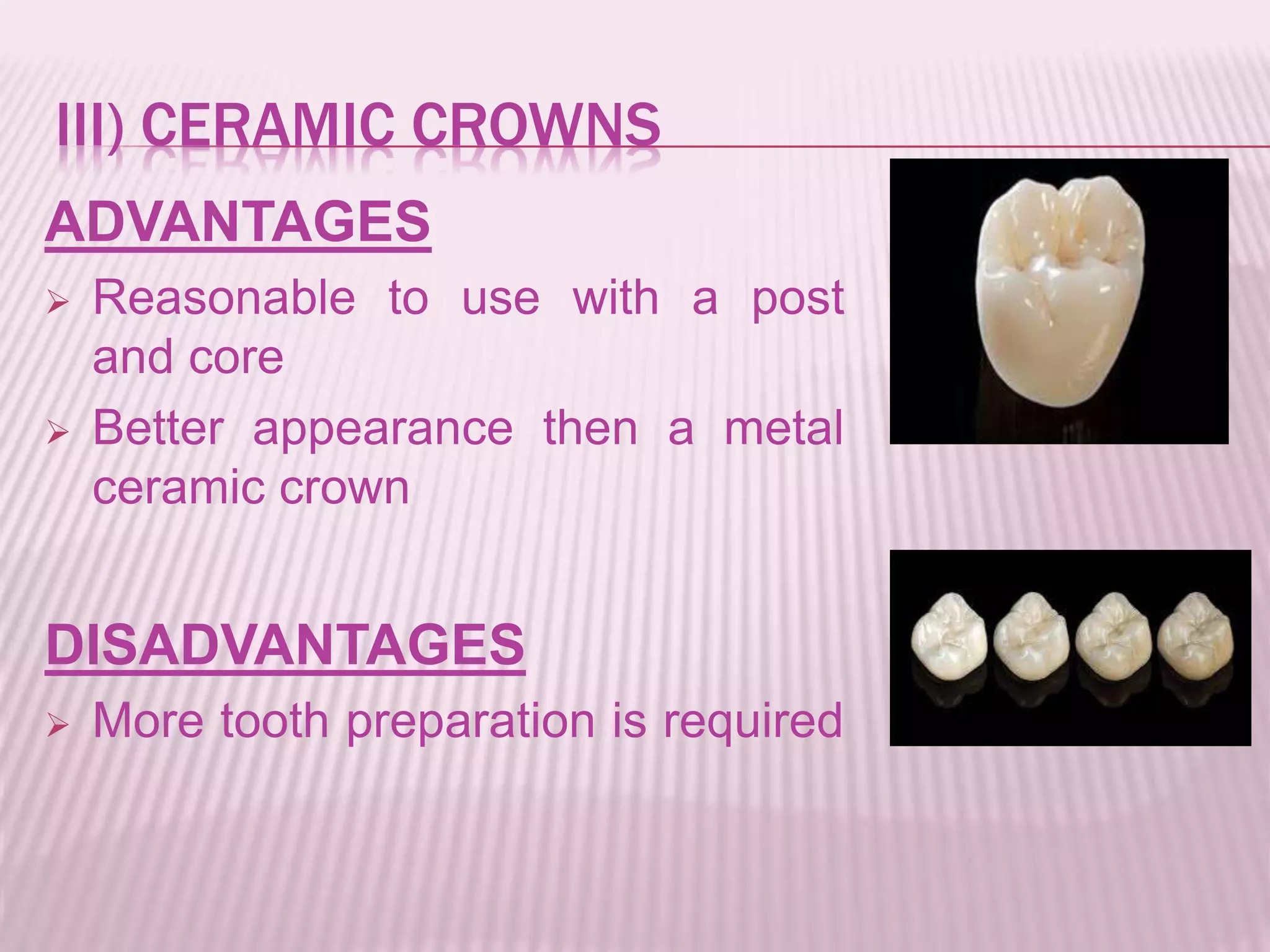III) CERAMIC CROWNS 
ADVANTAGES 
 Reasonable to use with a post 
and core 
 Better appearance then a metal 
ceramic crown 
DISADVANTAGES 
 More tooth preparation is required 
 
