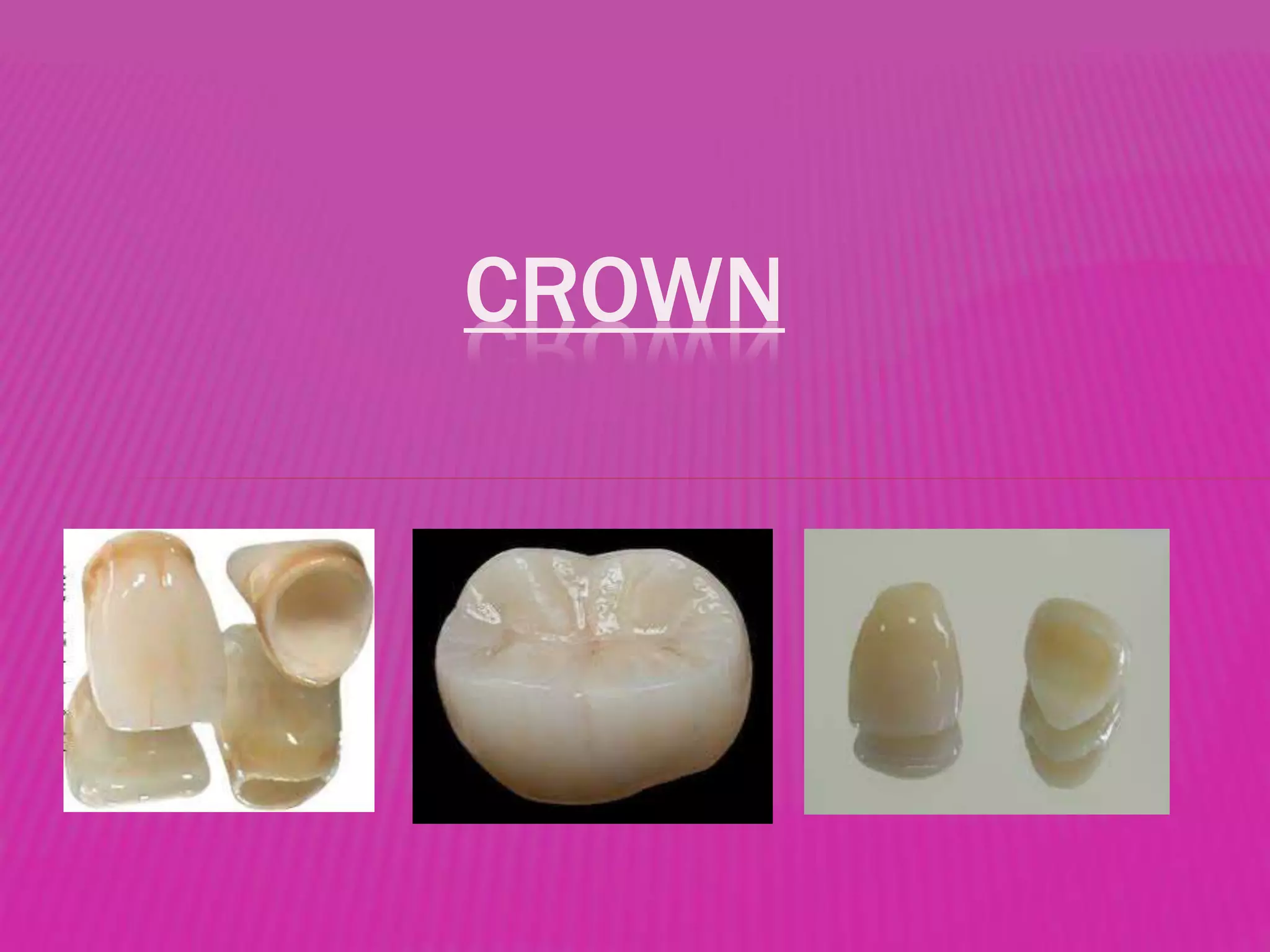 CROWN 
 