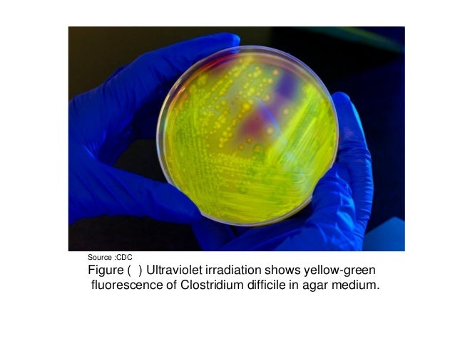 Types Of Culture Media Clostridium Difficile Agar Pptx5