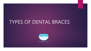 TYPES OF DENTAL BRACES
 