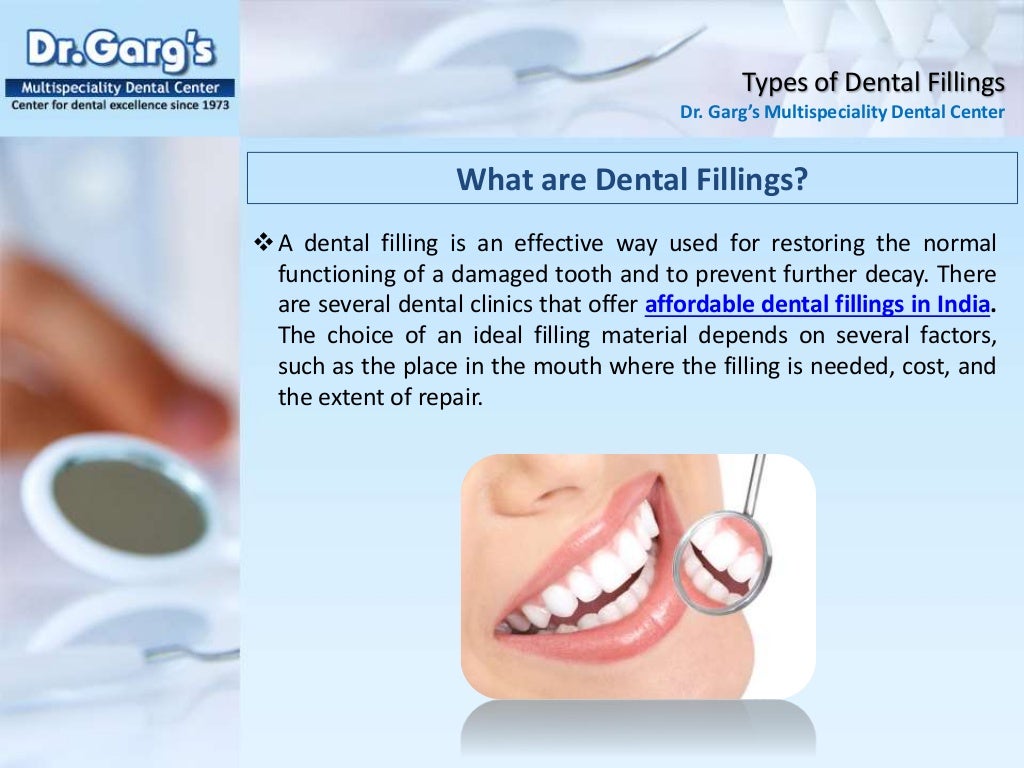 Types of Dental Fillings