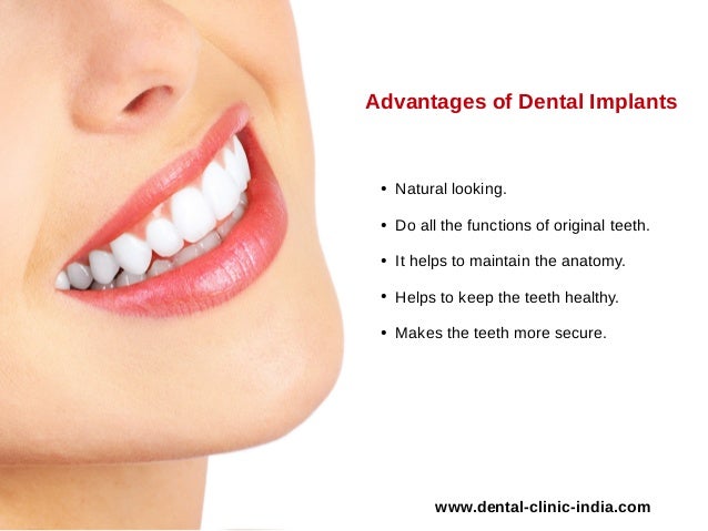 types of dental implants