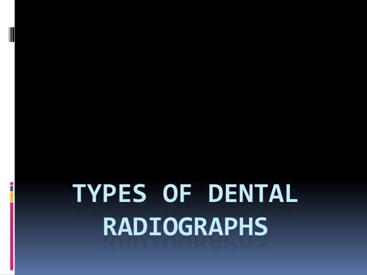 Types Of Dental Radiographs