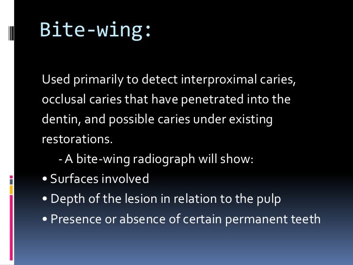 Types of dental radiographs in children