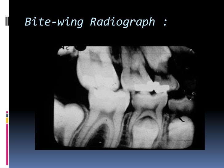 Types of dental radiographs in children