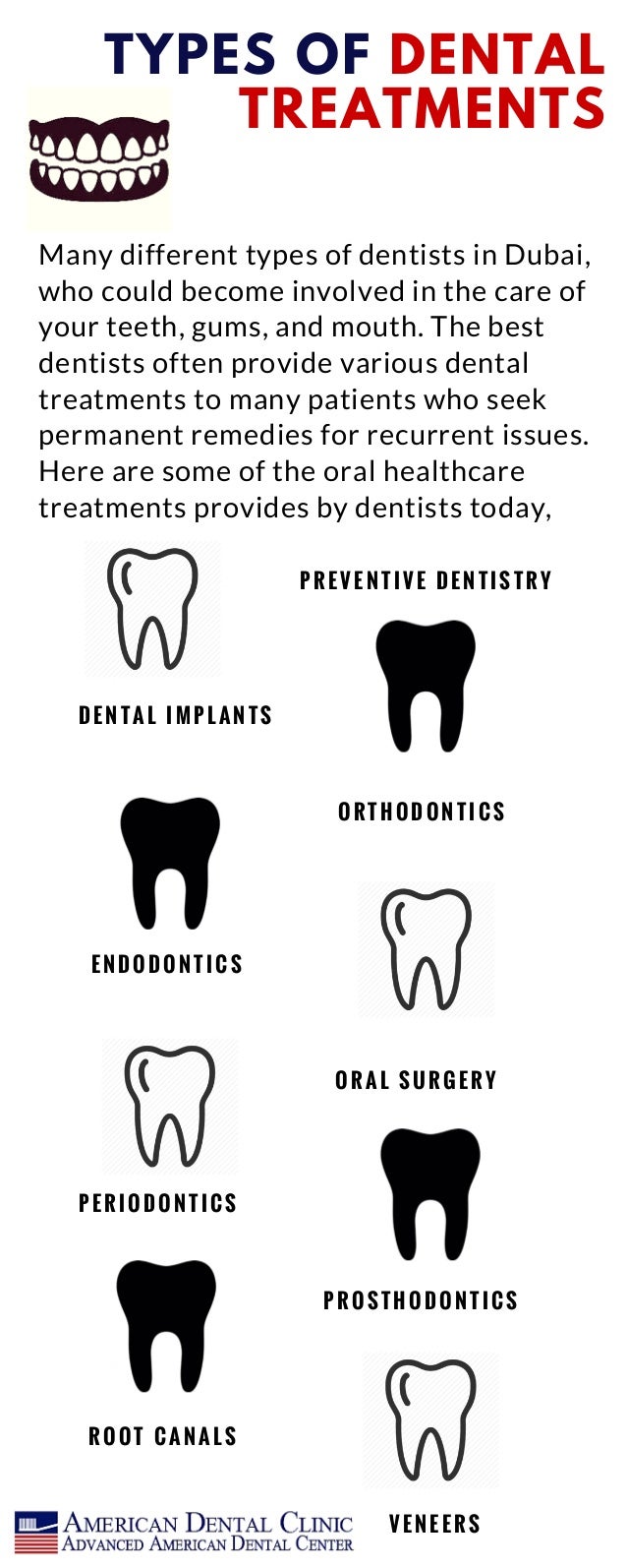 Types of dental treatment
